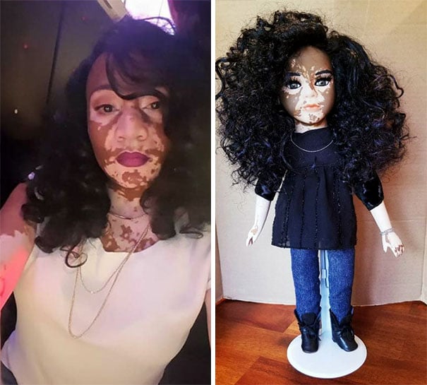 Artista crea muñecas con vitiligo