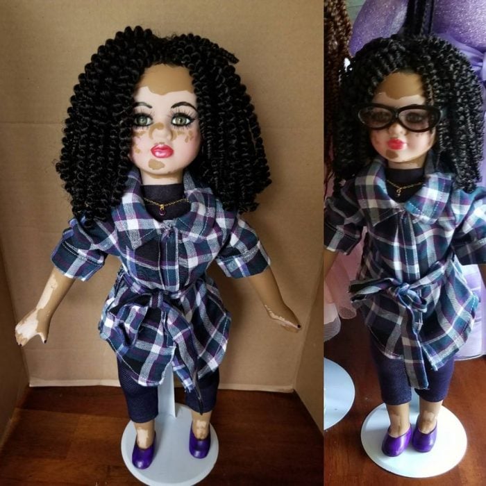 Artista crea muñecas con vitiligo