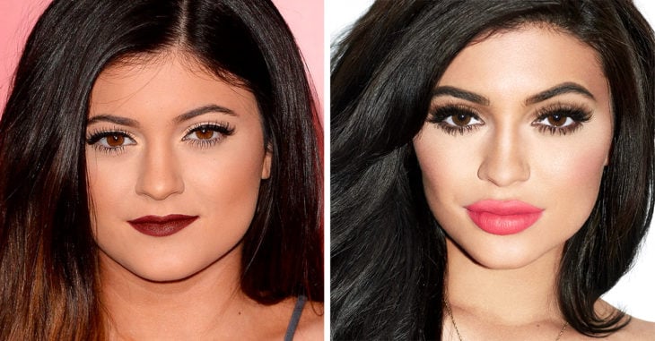 Kylie Jenner reveló la razón por la que se rellenó los labios