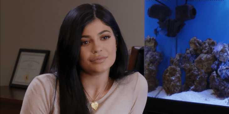 Kylie reveló que se operó los labios en una sesión de terapia 