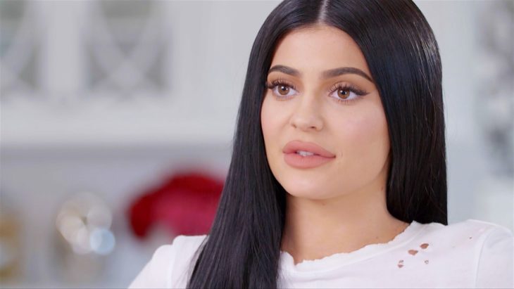 Kylie reveló que se operó los labios en una sesión de terapia 