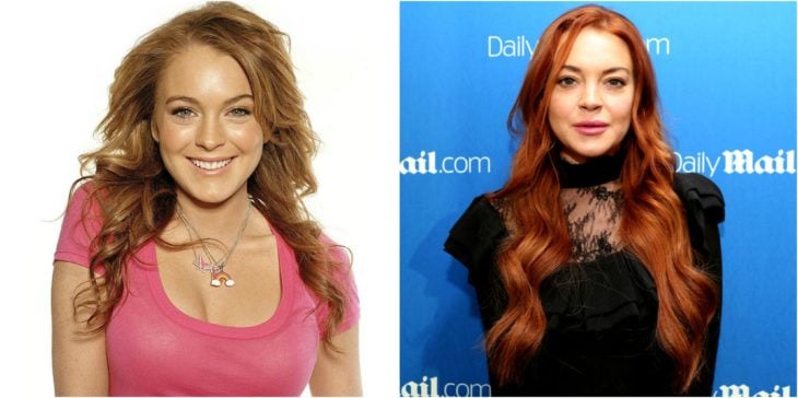 Lindsay Lohan cirugías