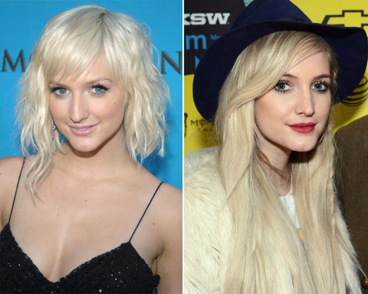 ashlee simpson cirugía