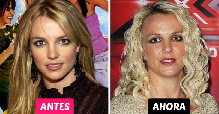 25 Celebridades que envejecieron terriblemente y lucen increíblemente diferentes