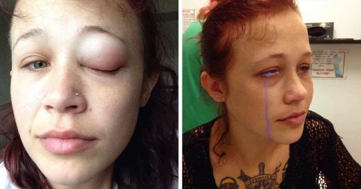 tatuaje en los ojos deja parcialmente ciega a una modelo