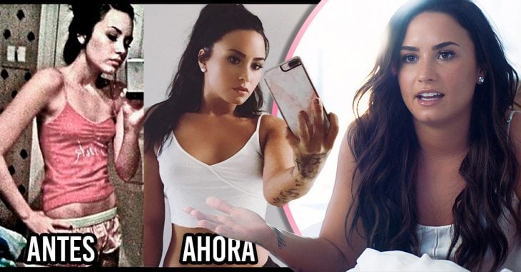 Demi Lovato compartió una imagen de su cuerpo antes y después de la anorexia; su recuperación ha sido increíble