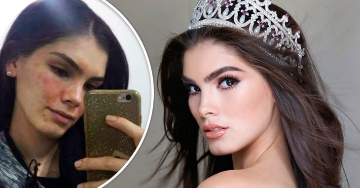 Miss México pública una imagen de sus imperfecciones y manda un mensaje para todas las chicas