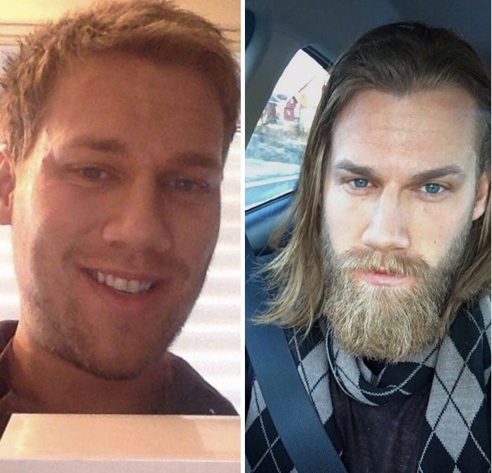 hombre mostrando su antes y después con barba
