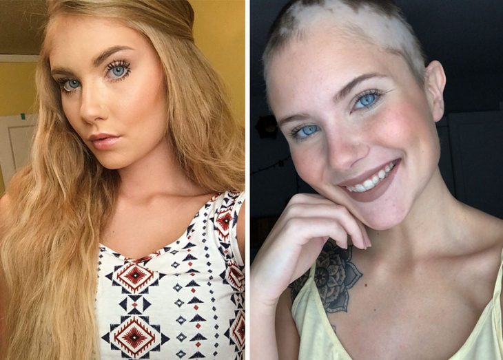 Chica sufre alopecia y su madre pinta flores para una sesión de fotos 