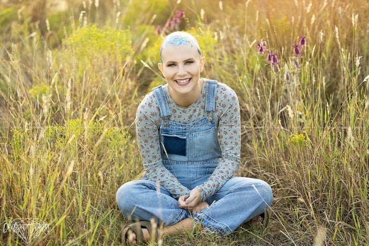 Chica sufre alopecia y su madre pinta flores para una sesión de fotos 