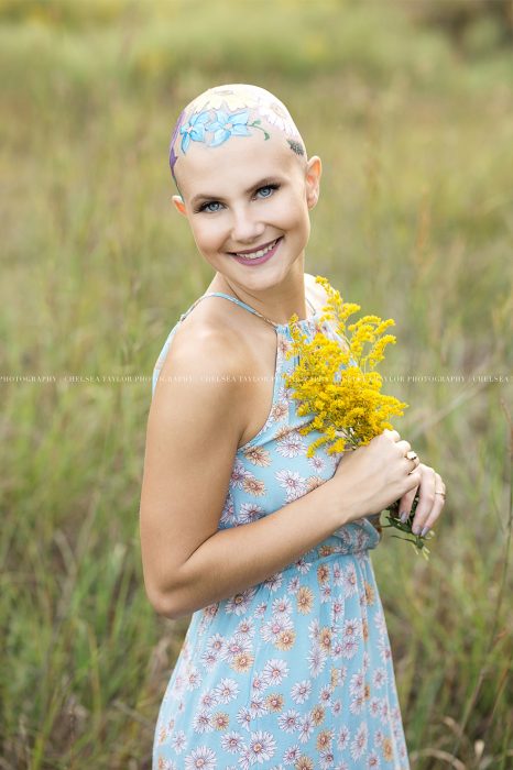 Chica sufre alopecia y su madre pinta flores para una sesión de fotos 