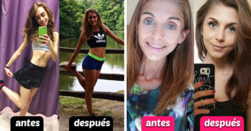 10 Mujeres que comparten imágenes del antes y después en sus trastornos alimenticios