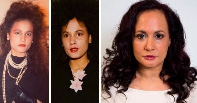 Asegura que no ha sonreído desde hace 40 años; ¡quería tener un rostro libre de arrugas!