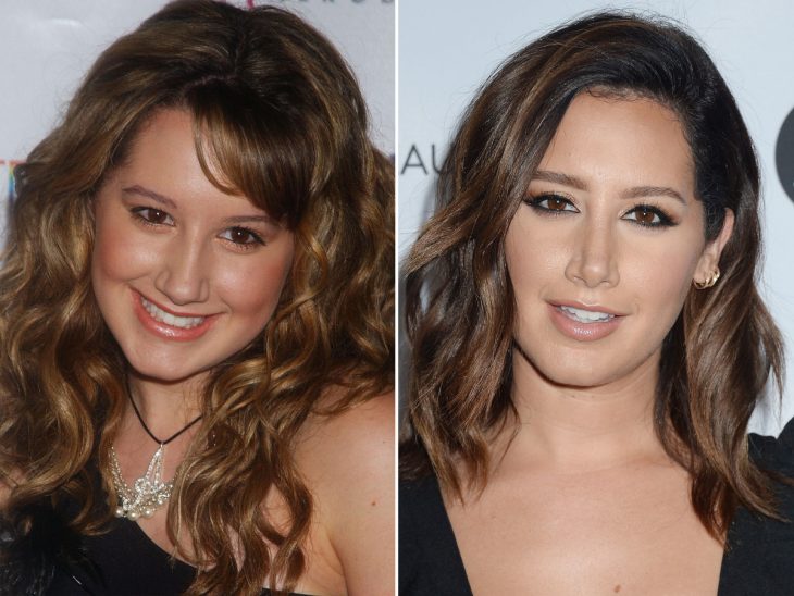 ashley tisdale antes y despues cirugía