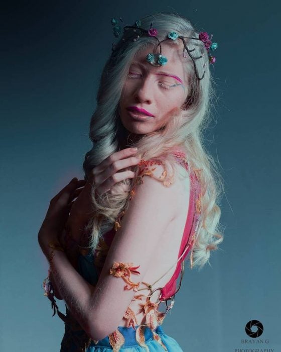 ruby vizcarra modelo albina mexicana