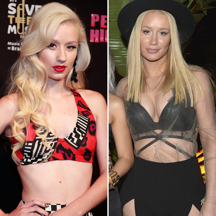 Iggy Azalea antes y después