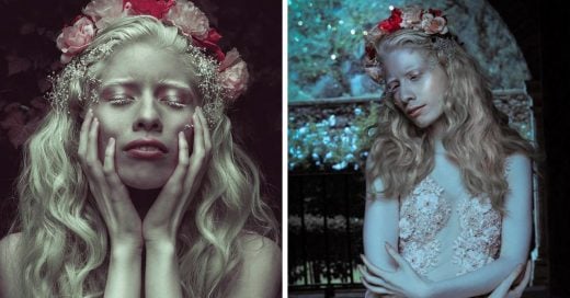 La modelo albina que sigue desafiando los estándares de belleza con su hermosa piel