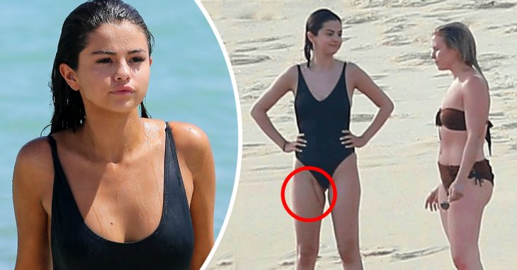 Selena Gomez reapareció con una nueva cicatriz y sus fans se encuentran preocupados