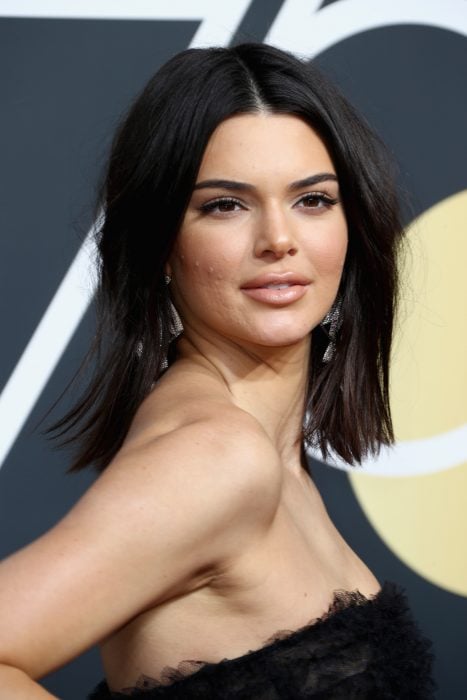 kendall jenner con acné
