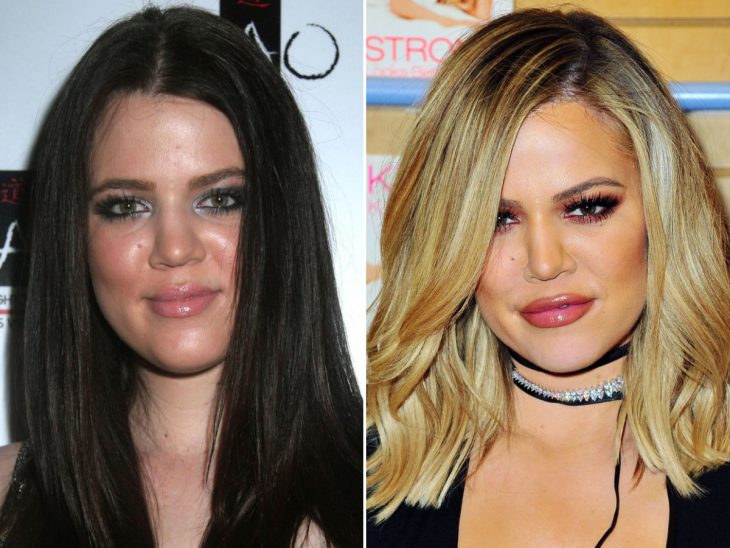 kloe kardashian antes y despues