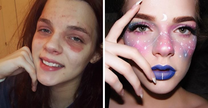Artista del maquillaje realza la belleza de su eczema en Instagram