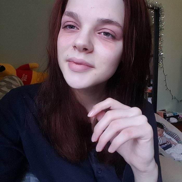 Chica que sufre de eccema y hace tutoriales para Instagram sobre maquillaje 
