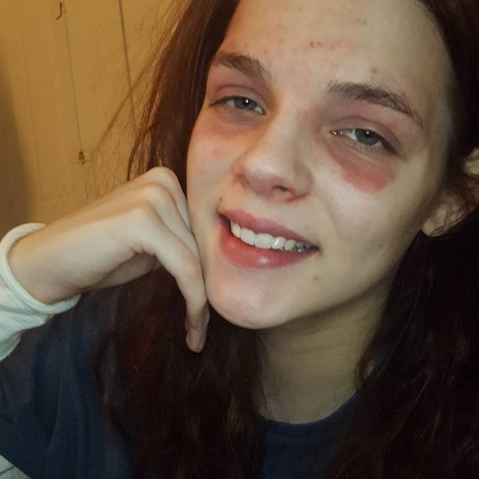Chica que sufre de eccema y hace tutoriales para Instagram sobre maquillaje 