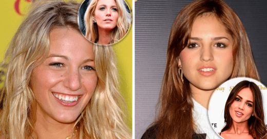 Celebs antes y despues de operarse la nariz