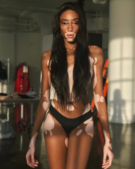 winnie harlow