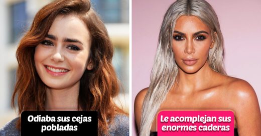 Celebridades que estuvieron acomplejadas con su físico