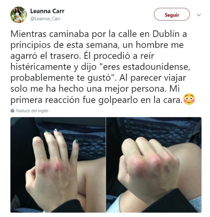 Comentarios en twitter de chica que se defendió de un acosador en Dublín 