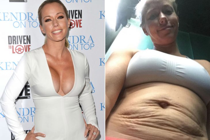 Kendra wilkns antes y después de ser madre 