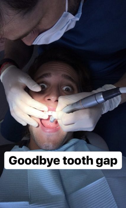 Diego Boneta separando sus dientes para interpretar a Luis Miguel