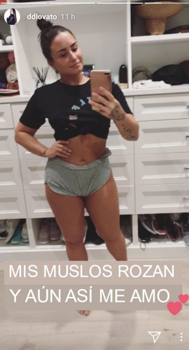 demi lovato estrías