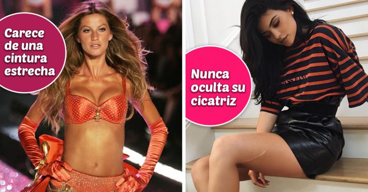 10 Famosas que aman sus defectos físicos y los convirtieron en sus fortalezas