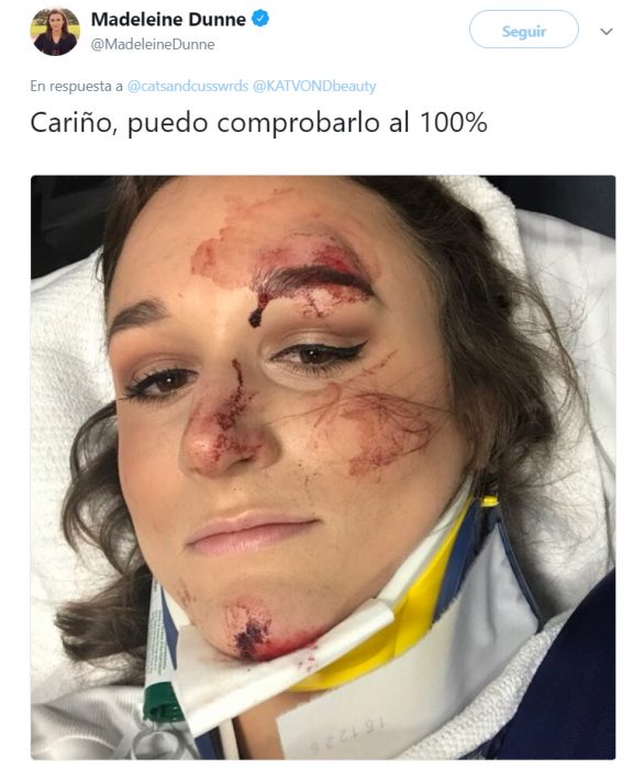 Chica que sobrevivio a accidente con delineador intacto 