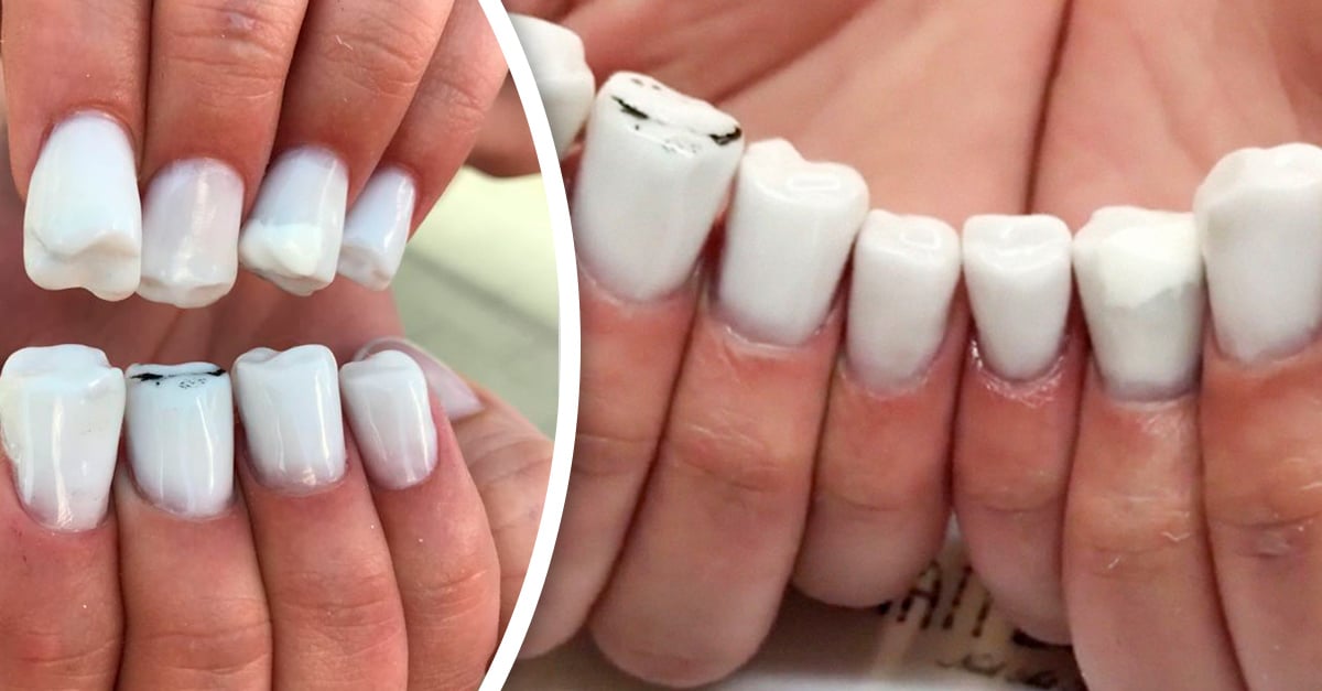 ¿Imaginas tener los dientes en las uñas? Así es como lucen