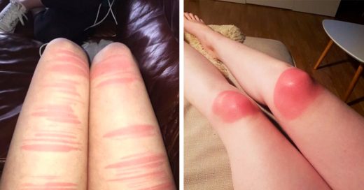 15 Chicas que pasaron un mal momento con sus jeans rasgados