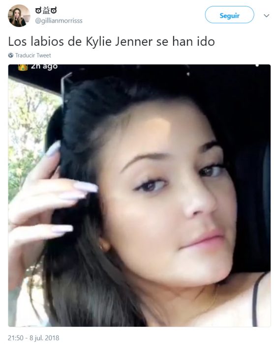 Comentarios en Instagram acerca de los nuevos labios de Kylie Jenner 