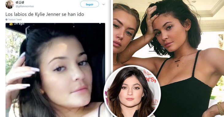 Kylie Jenner le dijo adiós a sus labios gruesos