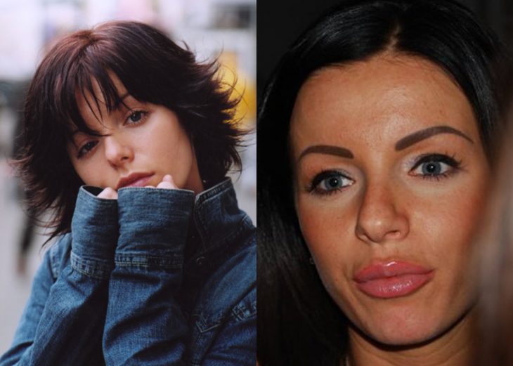 Famosas antes y después de las cirugías plásticas
