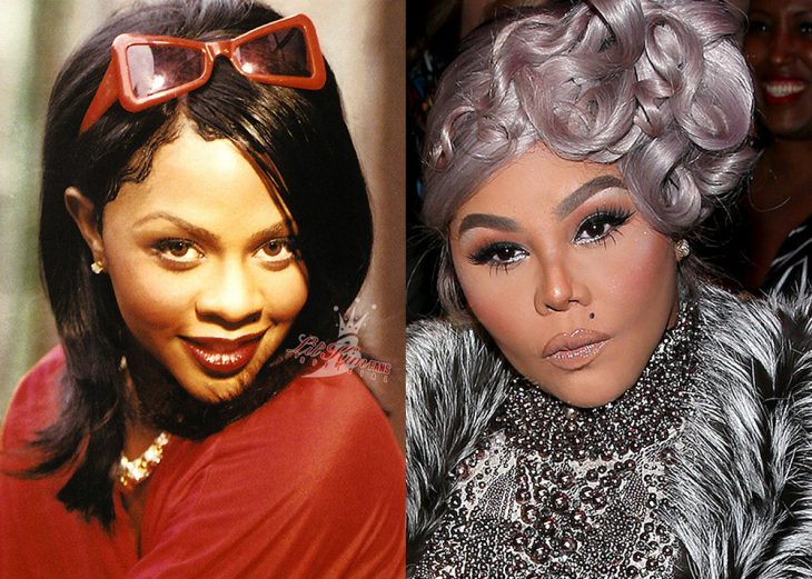 Famosas antes y después de las cirugías plásticas