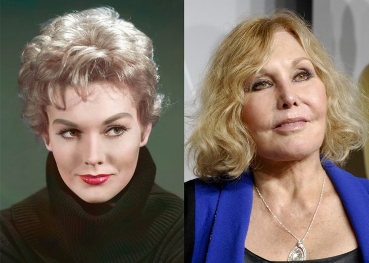 Famosas antes y después de las cirugías plásticas