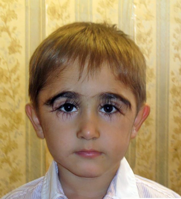 Niño ruso con las pestañas de 5 centímetros
