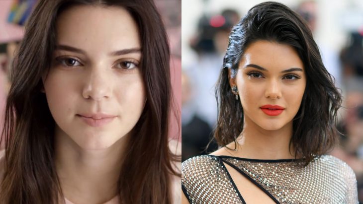 Kendall Jenner antes y después