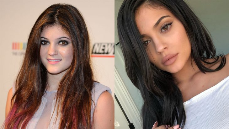 Kylie Jenner antes y después