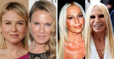 10 Famosas que perdieron sus rasgos naturales cuando abusaron de las cirugías estéticas