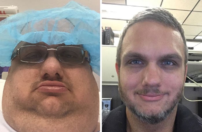 Personas antes y después de haber perdido peso 