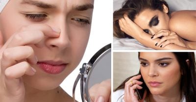 5 Hábitos que provocan que te salgan puntos negros y no tenías idea