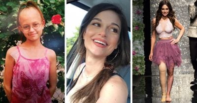 A los 11 años ganó la lucha más importante; hoy modela orgullosa frente al mundo